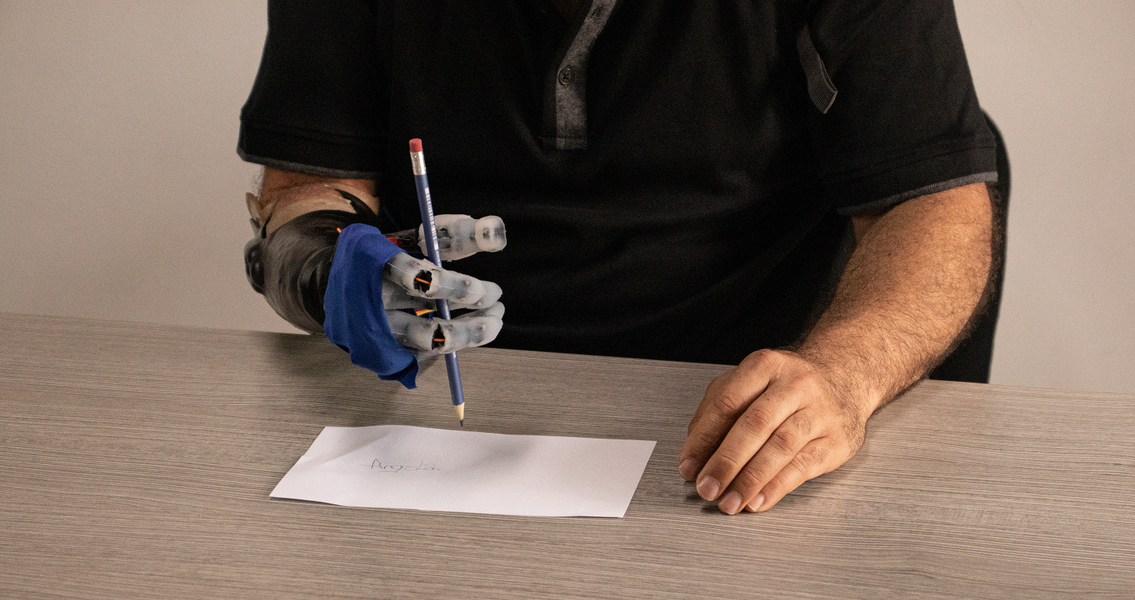 Próstesis mano (5).png