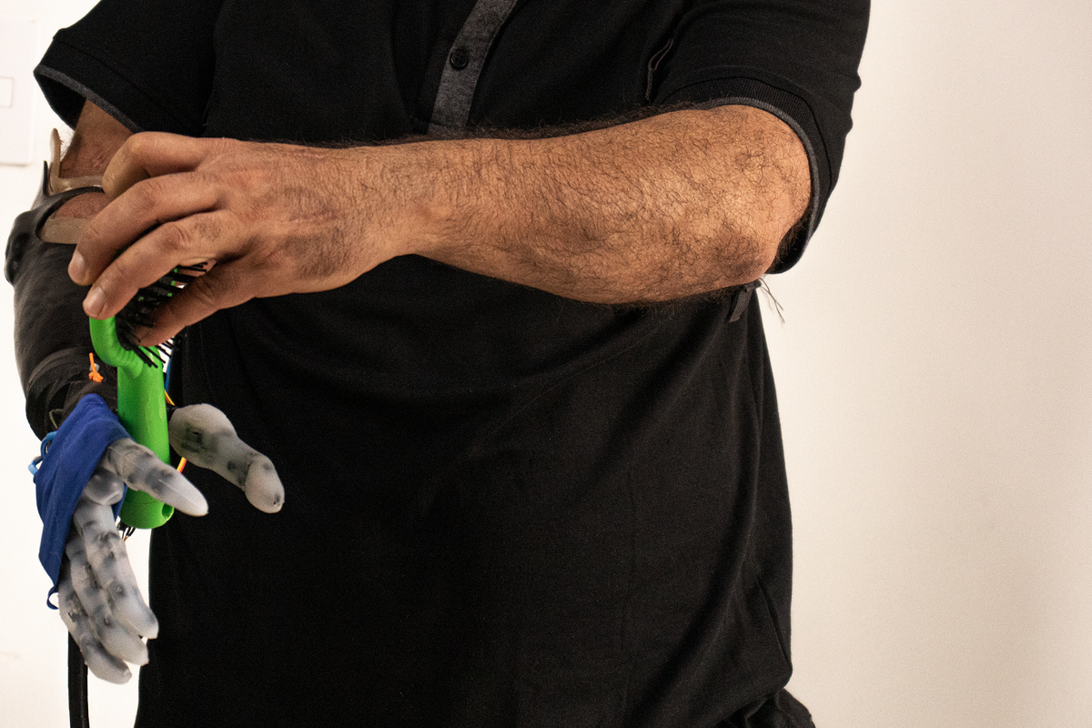 Prótesis mano Escuela Colombiana de Ingeniería (1).png